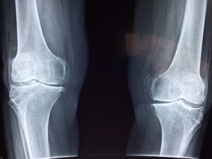 Divan Medical - knee X-ray