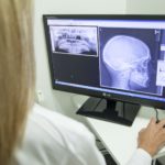 Divan Medical - X-ray on computer