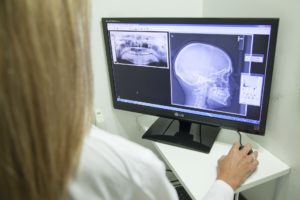 Divan Medical - X-ray on computer